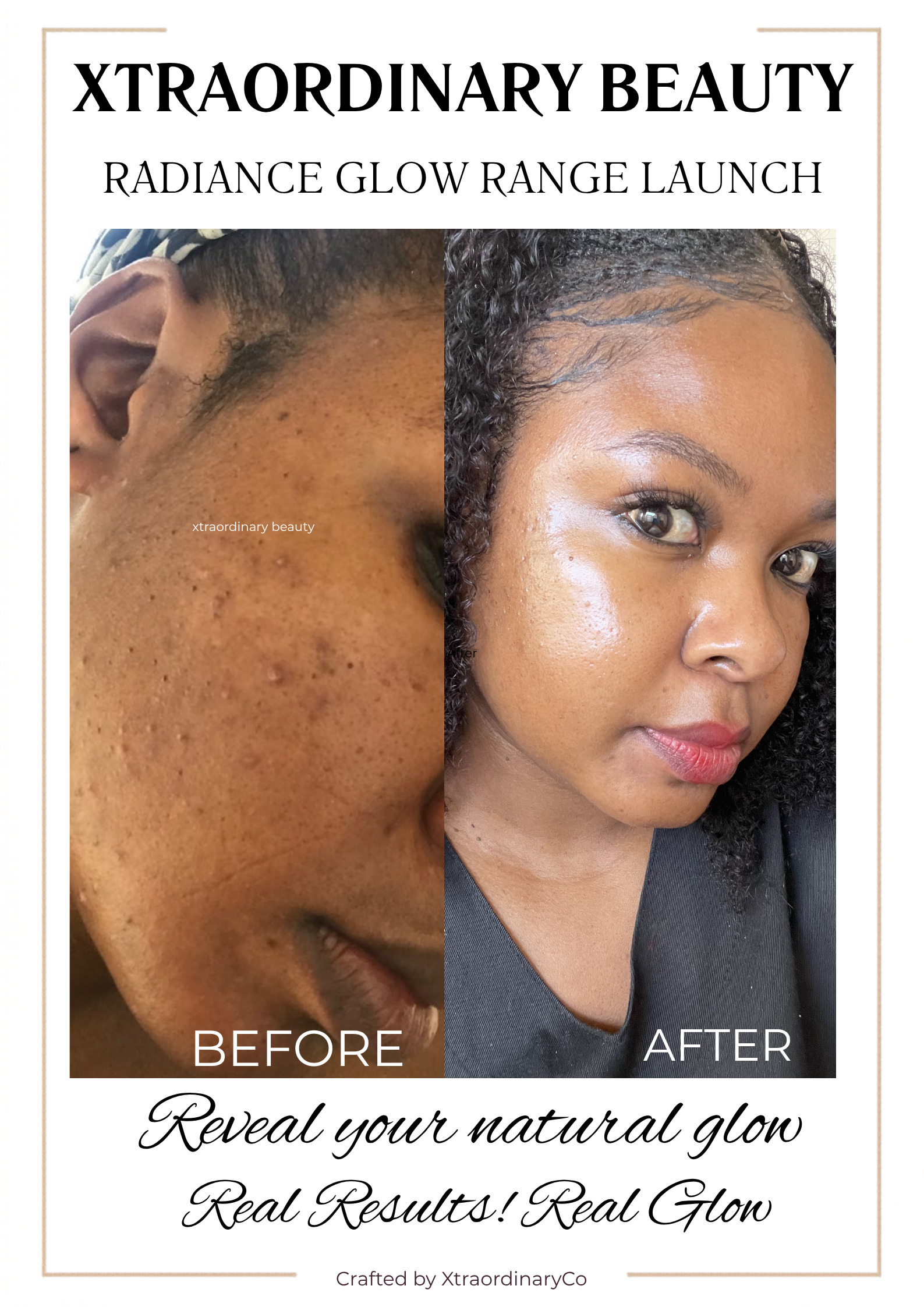 Xtraordinary Glow Bundle